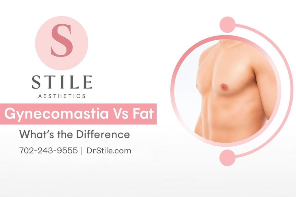 Gynecomastia Vs. Fat